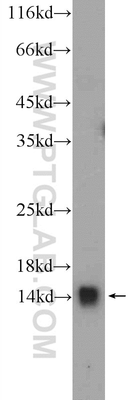 Western Blot (WB) analysis of mouse brain tissue using YPEL5 Polyclonal antibody (11730-1-AP)