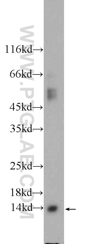 WB analysis of mouse brain using 11730-1-AP