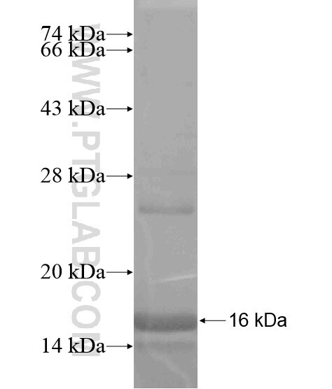 YPEL5 fusion protein Ag20399 SDS-PAGE YPEL5 fusion protein Ag20399 SDS-PAGE