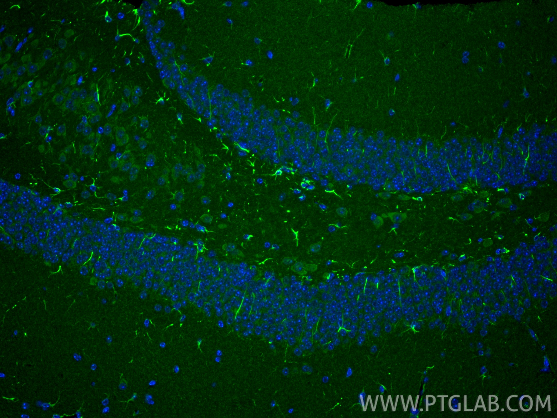 Immunofluorescence (IF) / fluorescent staining of mouse brain tissue using YRDC Polyclonal antibody (26295-1-AP)