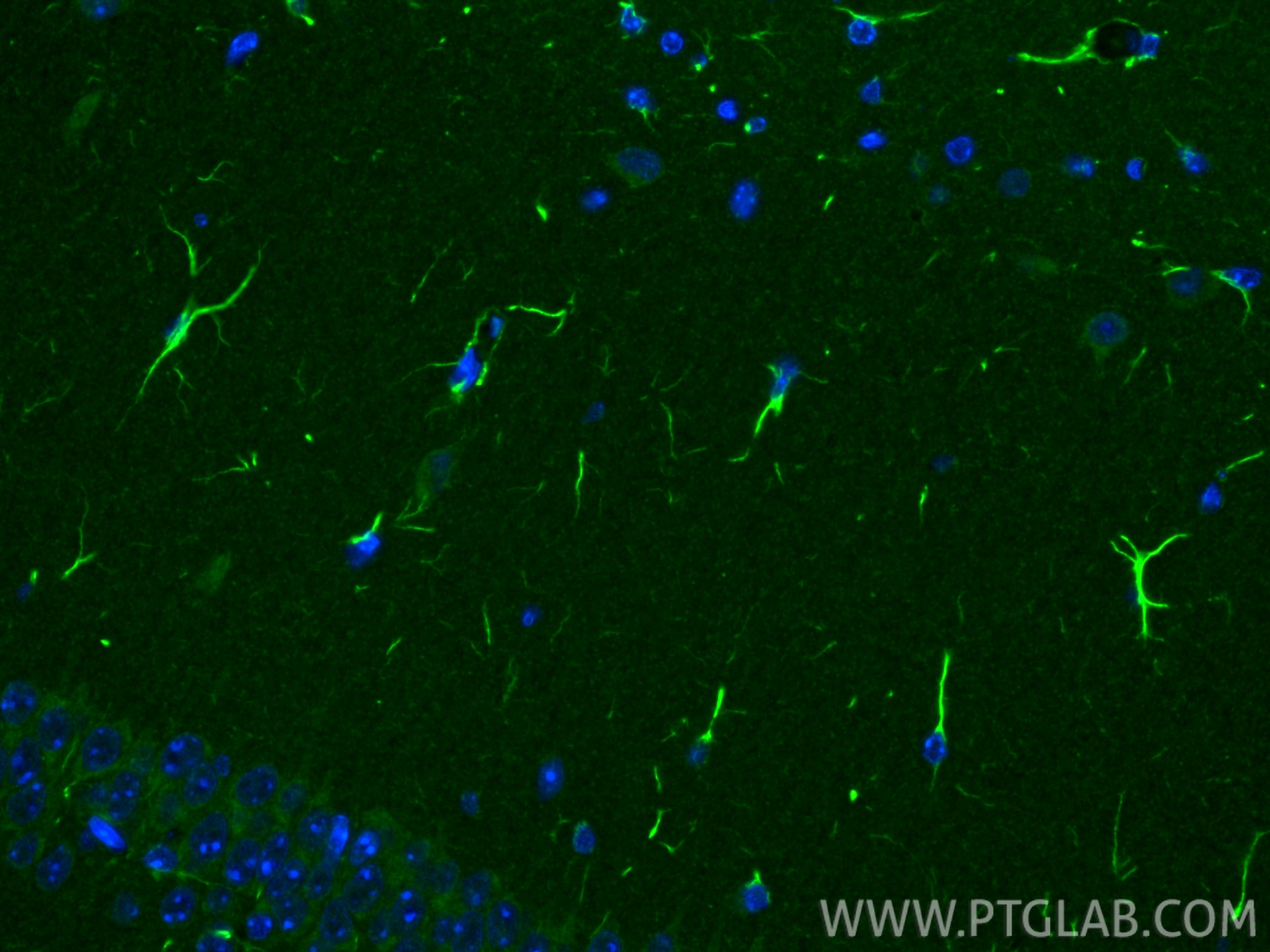 Immunofluorescence (IF) / fluorescent staining of mouse brain tissue using YRDC Polyclonal antibody (26295-1-AP)