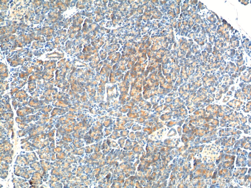 Immunohistochemistry (IHC) staining of human pancreas tissue using YRDC Polyclonal antibody (26295-1-AP)