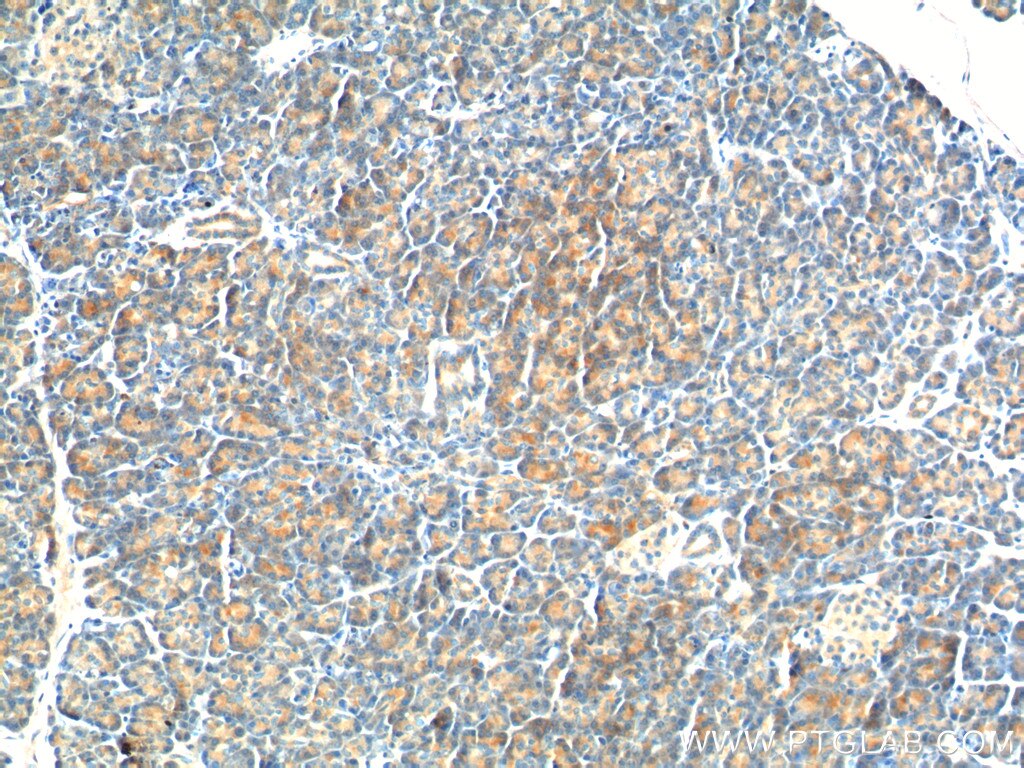 Immunohistochemistry (IHC) staining of human pancreas tissue using YRDC Polyclonal antibody (26295-1-AP)