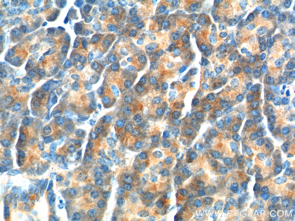 IHC staining of human pancreas using 26295-1-AP