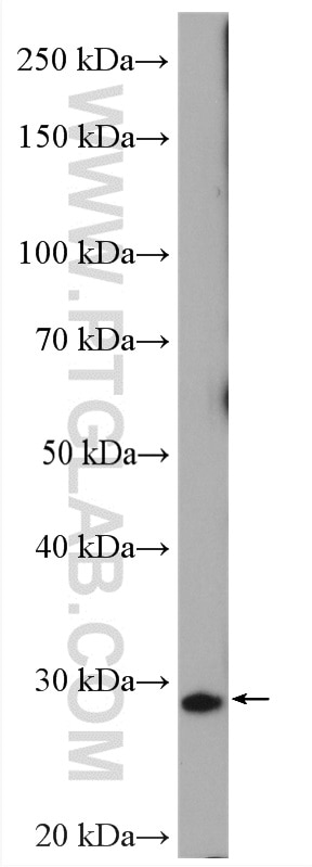 Western Blot (WB) analysis of RAW 264.7 cells using YRDC Polyclonal antibody (26295-1-AP)