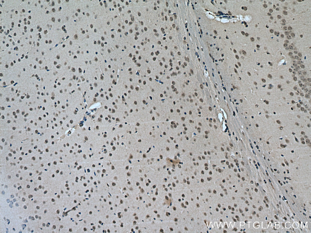 Immunohistochemistry (IHC) staining of mouse brain tissue using YTHDC1 Polyclonal antibody (14392-1-AP)