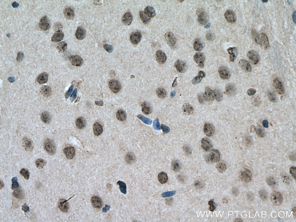 Immunohistochemistry (IHC) staining of mouse brain tissue using YTHDC1 Polyclonal antibody (14392-1-AP)