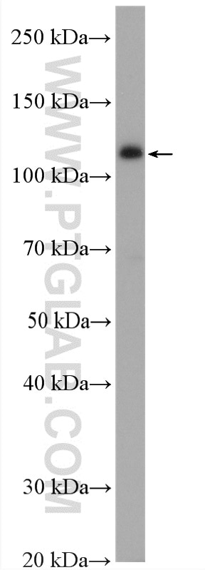 Western Blot (WB) analysis of HEK-293 cells using YTHDC1 Polyclonal antibody (14392-1-AP)