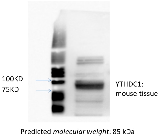 Western Blot (WB) analysis of mouse tissue using YTHDC1 Polyclonal antibody (14392-1-AP)
