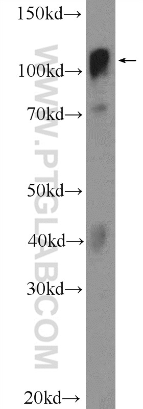 Western Blot (WB) analysis of MCF-7 cells using YTHDC1 Polyclonal antibody (14392-1-AP)