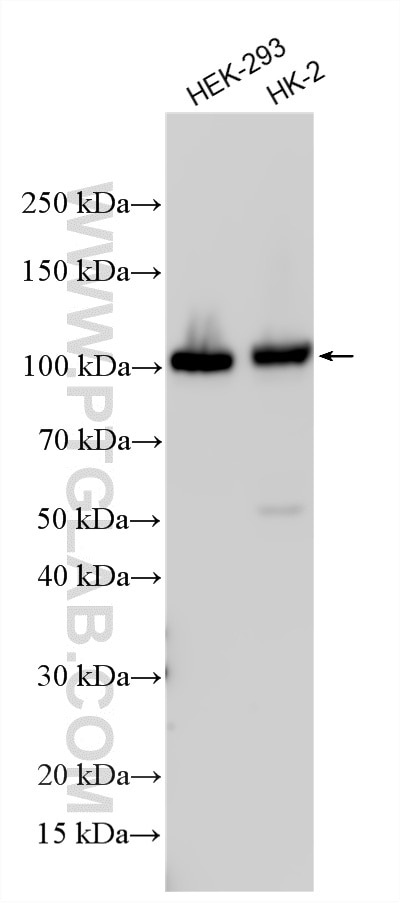 Western Blot (WB) analysis of various lysates using YTHDC1 Polyclonal antibody (14392-1-AP)