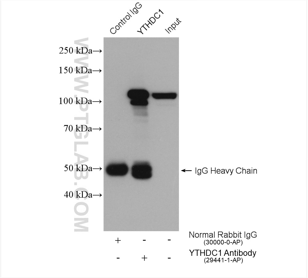 Immunoprecipitation (IP) experiment of HEK-293 cells using YTHDC1 Polyclonal antibody (29441-1-AP)