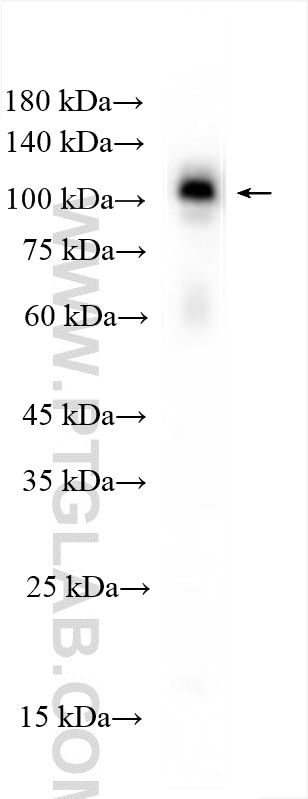 WB analysis of HepG2 using 29441-1-AP