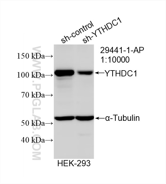 Western Blot (WB) analysis of HEK-293 cells using YTHDC1 Polyclonal antibody (29441-1-AP)