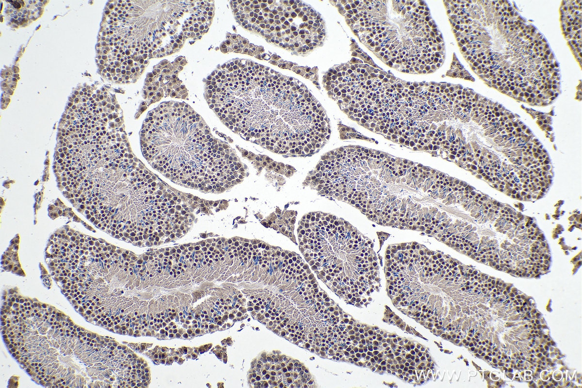 Immunohistochemistry (IHC) staining of mouse testis tissue using YTHDC1 Monoclonal antibody (67911-1-Ig)