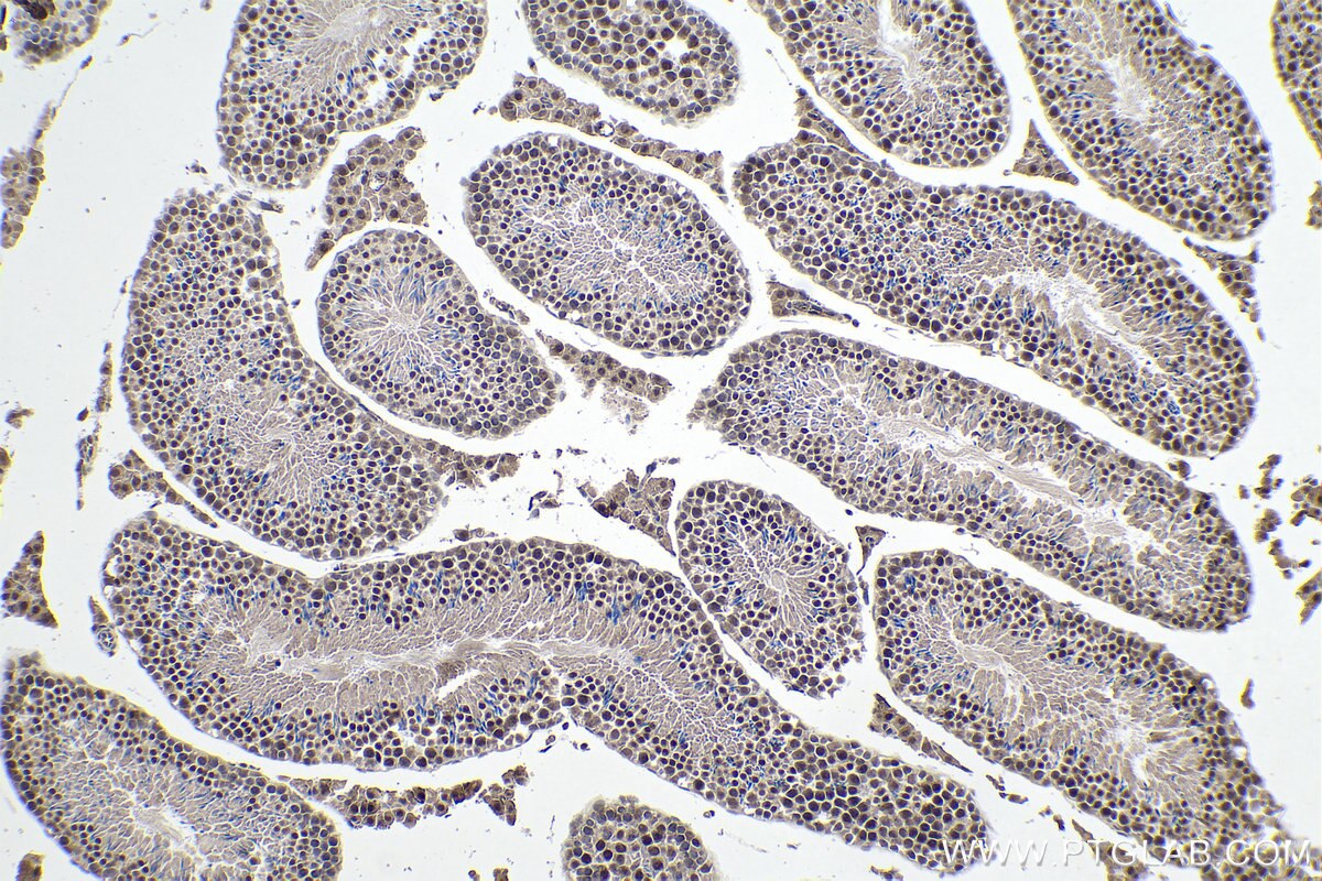 IHC staining of mouse testis using 67911-1-Ig