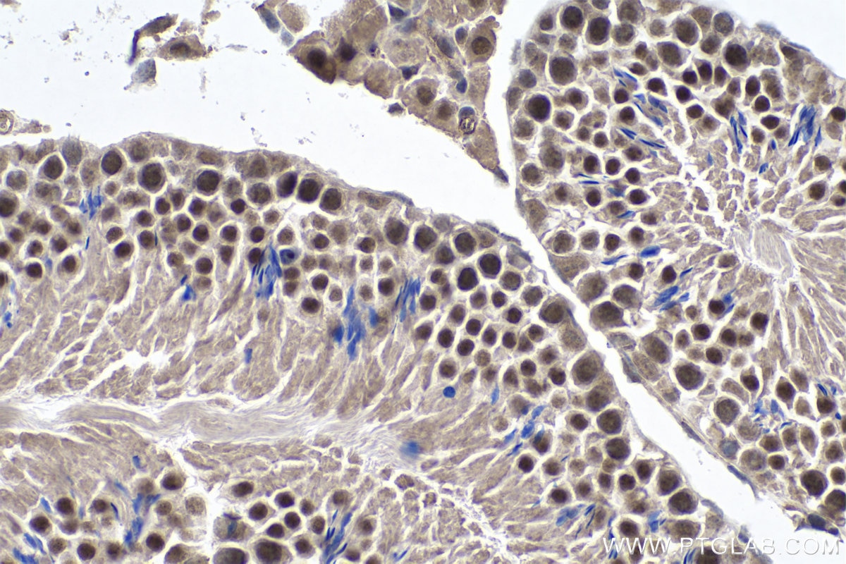 Immunohistochemistry (IHC) staining of mouse testis tissue using YTHDC1 Monoclonal antibody (67911-1-Ig)
