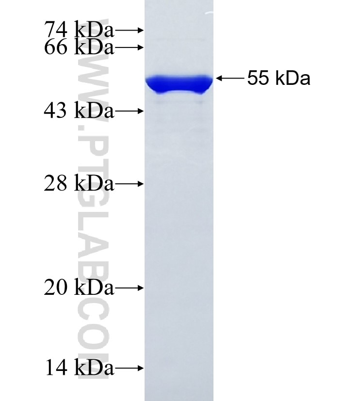 YTHDC1 fusion protein Ag31459 SDS-PAGE
