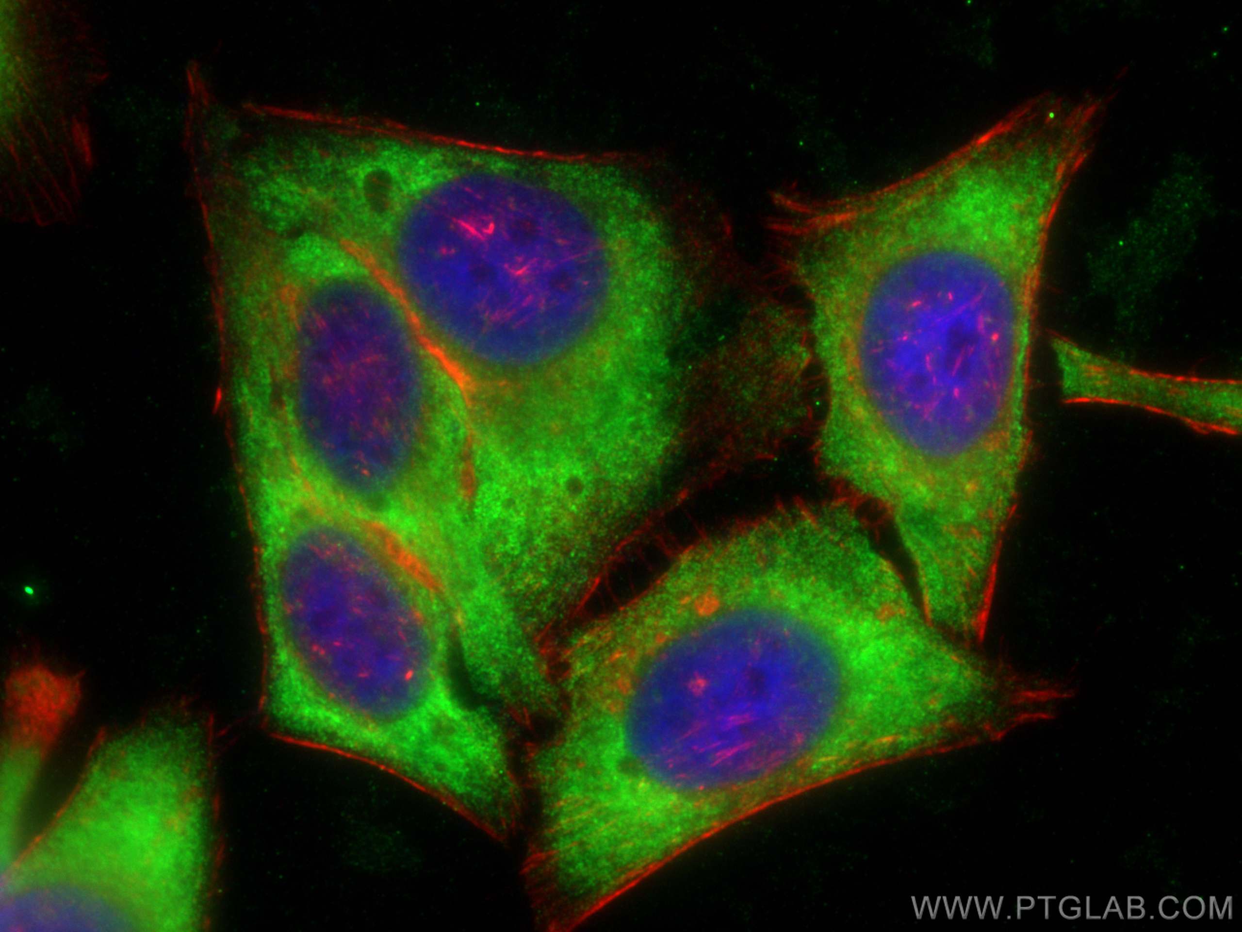Immunofluorescence (IF) / fluorescent staining of HepG2 cells using YTHDC2 Polyclonal antibody (27779-1-AP)
