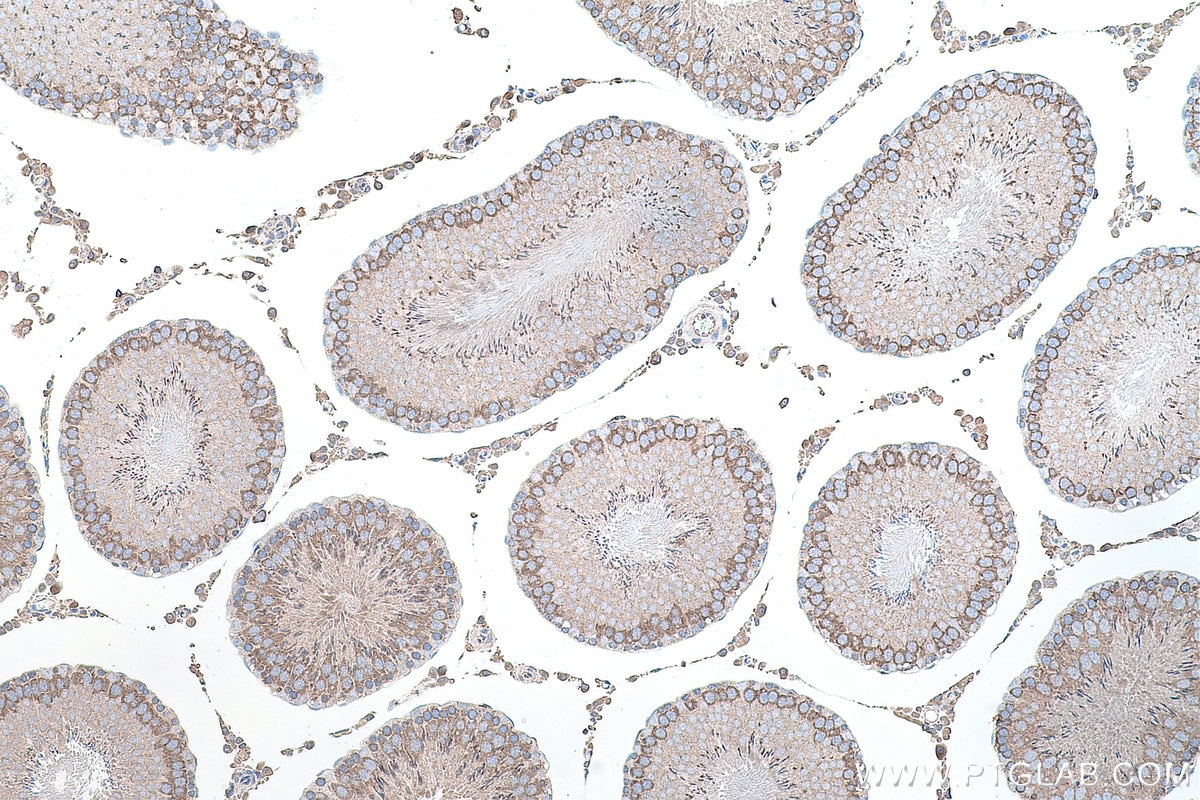 Immunohistochemistry (IHC) staining of rat testis tissue using YTHDC2 Polyclonal antibody (27779-1-AP)