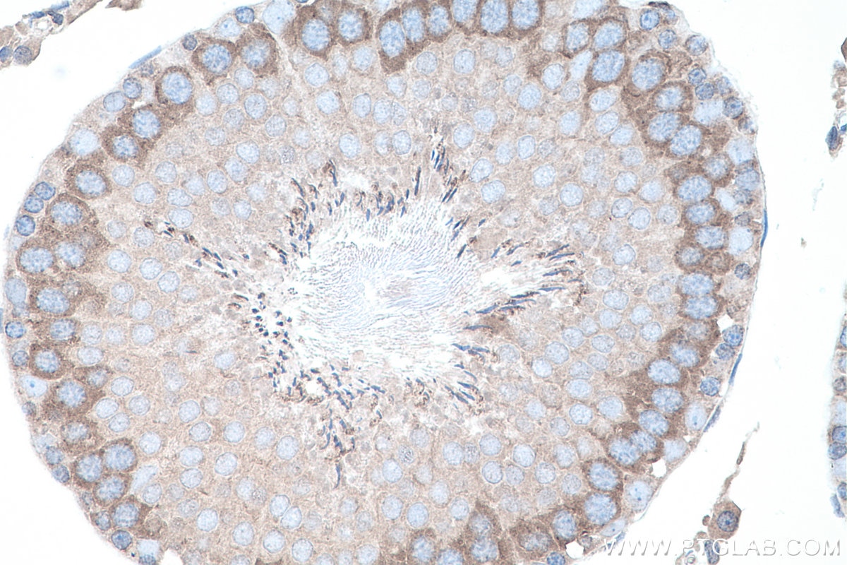 IHC staining of rat testis using 27779-1-AP