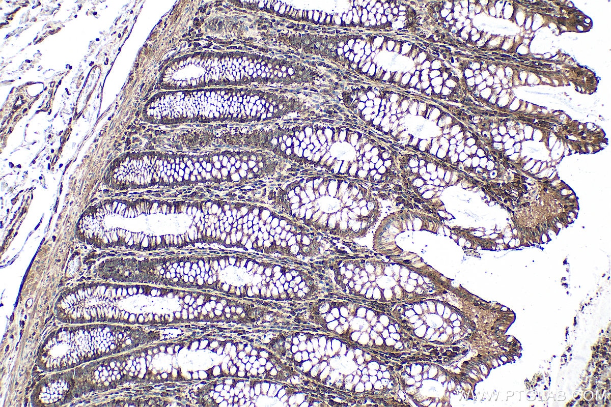 Immunohistochemistry (IHC) staining of human colon tissue using YTHDC2 Polyclonal antibody (27779-1-AP)