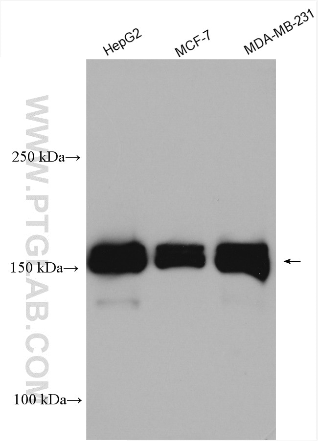 Western Blot (WB) analysis of various lysates using YTHDC2 Polyclonal antibody (27779-1-AP)