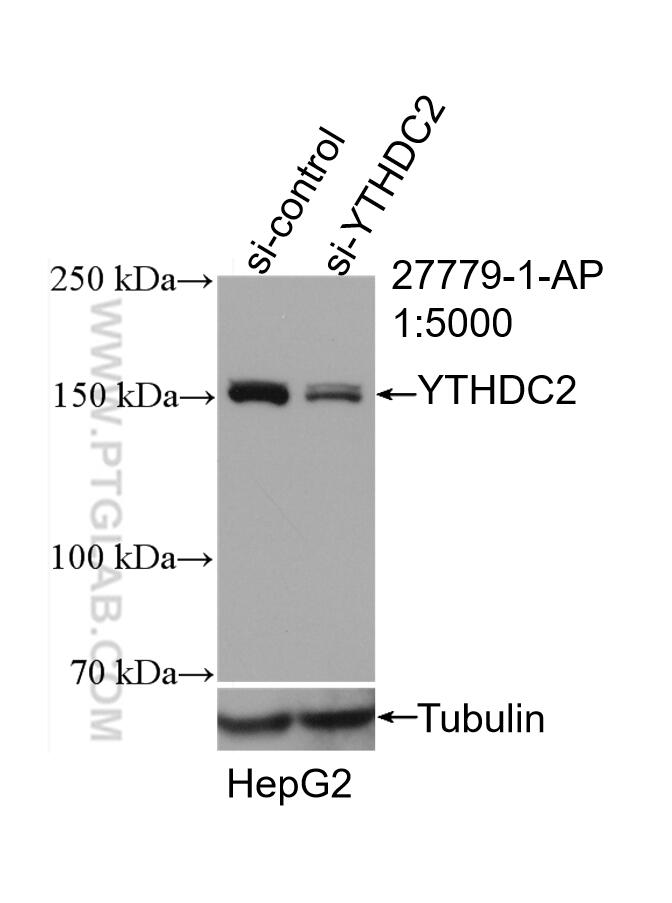 Western Blot (WB) analysis of HepG2 cells using YTHDC2 Polyclonal antibody (27779-1-AP)