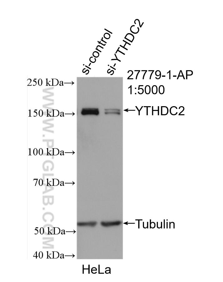 Western Blot (WB) analysis of HeLa cells using YTHDC2 Polyclonal antibody (27779-1-AP)