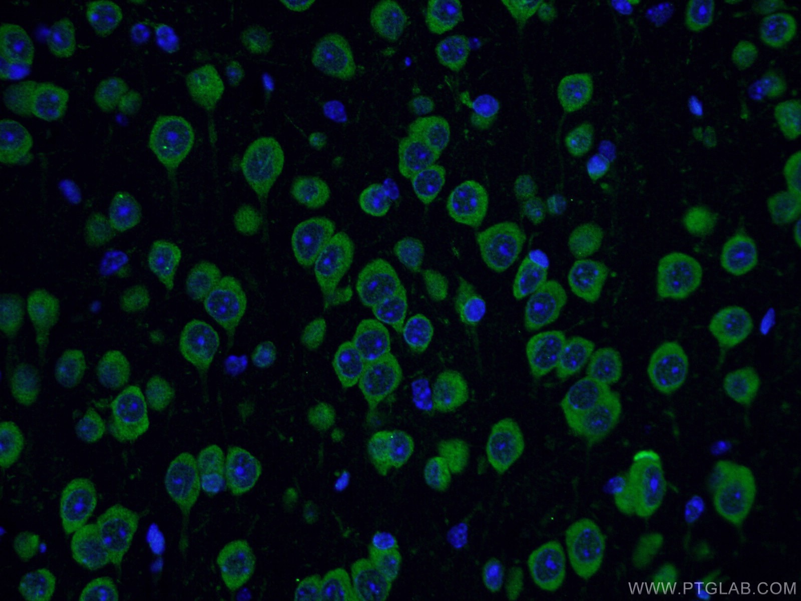 Immunofluorescence (IF) / fluorescent staining of mouse brain tissue using YTHDF1 Polyclonal antibody (17479-1-AP)