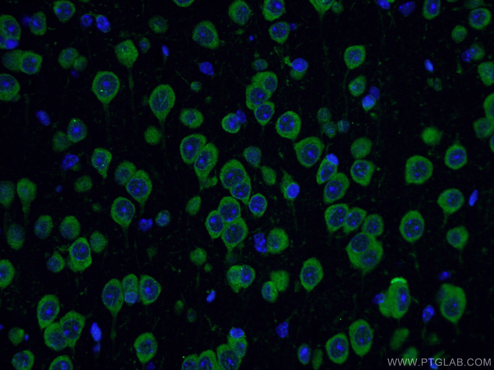 IF Staining of mouse brain using 17479-1-AP