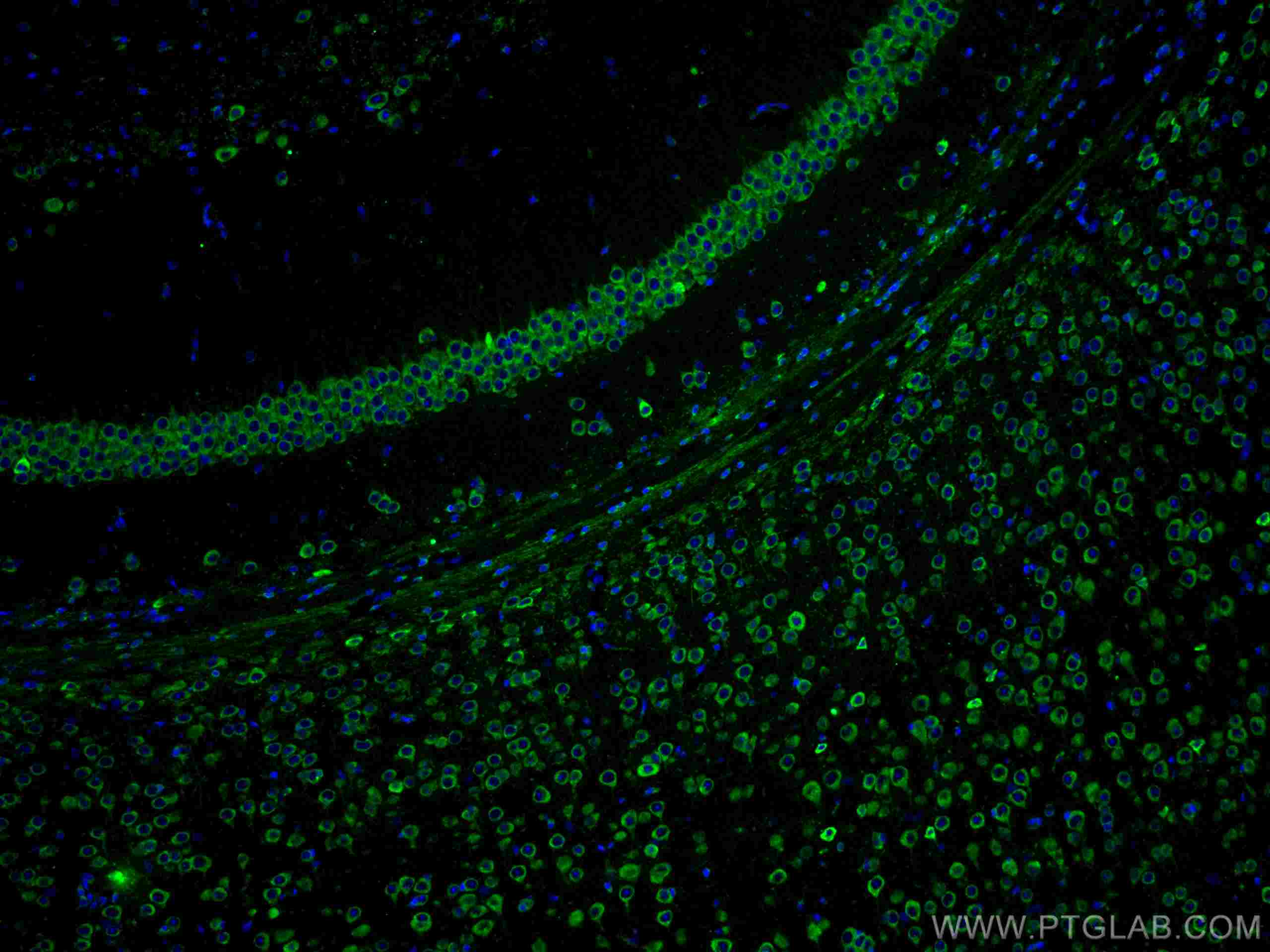 Immunofluorescence (IF) / fluorescent staining of mouse brain tissue using YTHDF1 Polyclonal antibody (17479-1-AP)