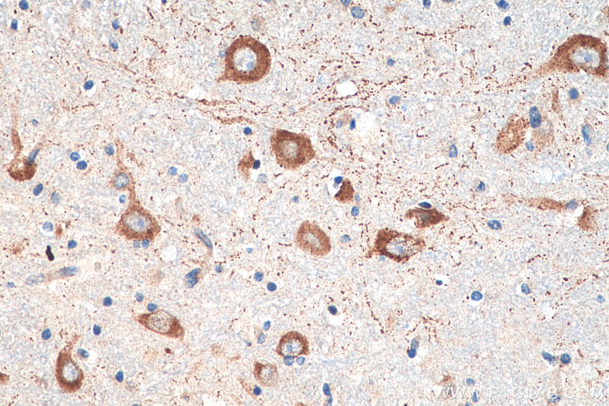 Immunohistochemistry (IHC) staining of human hypothalamus tissue using YTHDF1 Polyclonal antibody (17479-1-AP)