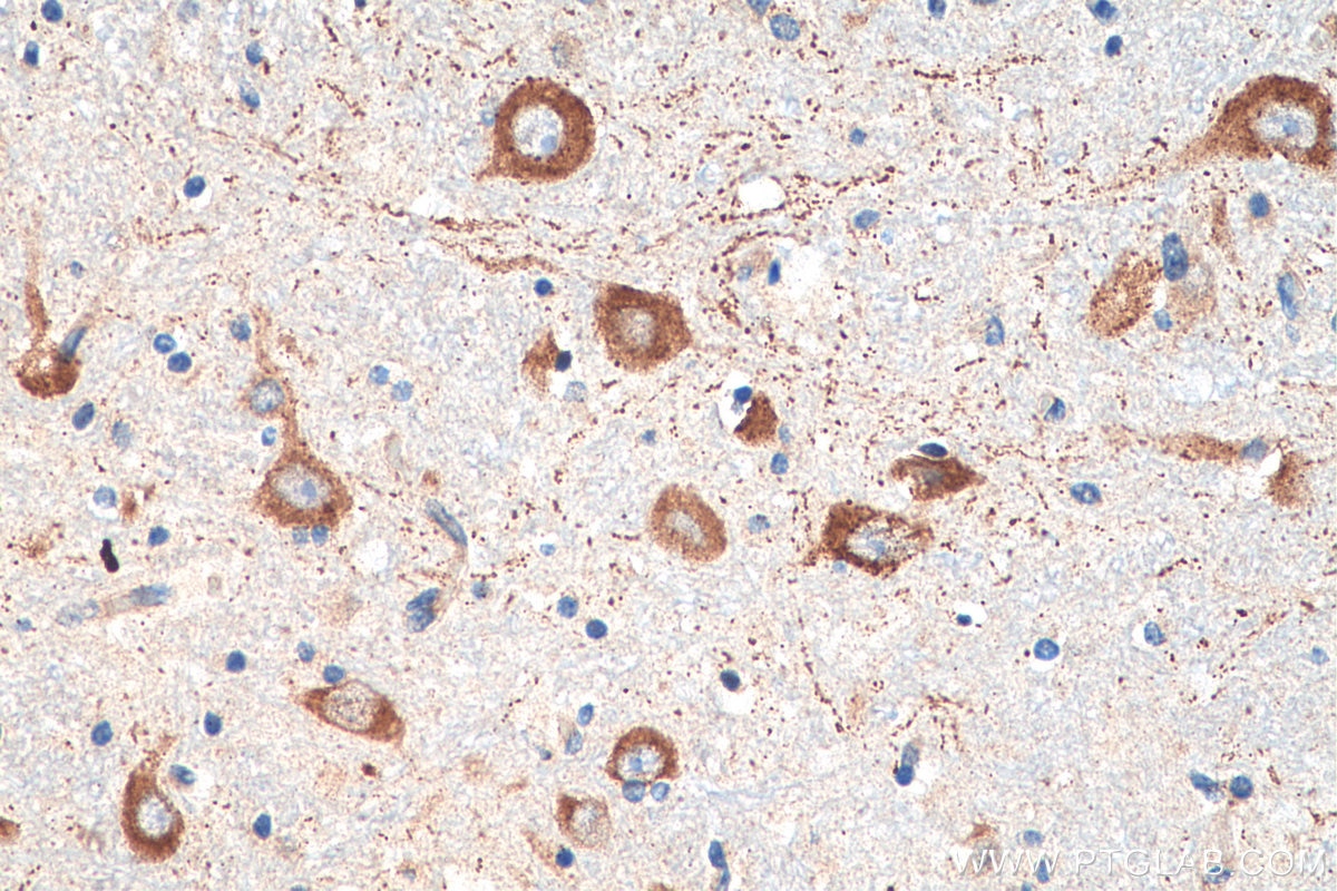 IHC staining of human hypothalamus using 17479-1-AP