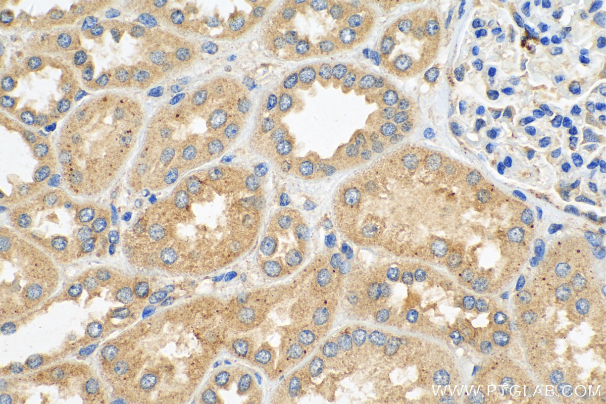 Immunohistochemistry (IHC) staining of human kidney tissue using YTHDF1 Polyclonal antibody (17479-1-AP)