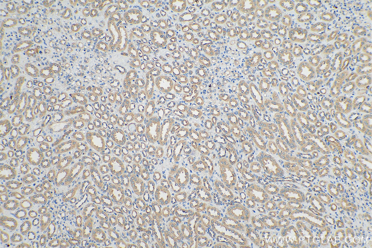 Immunohistochemistry (IHC) staining of human kidney tissue using YTHDF1 Polyclonal antibody (17479-1-AP)