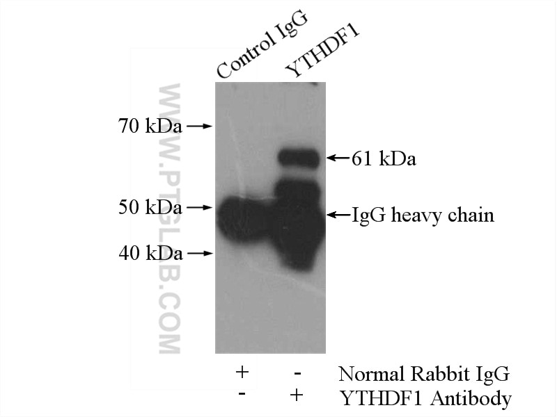Immunoprecipitation (IP) experiment of mouse brain tissue using YTHDF1 Polyclonal antibody (17479-1-AP)
