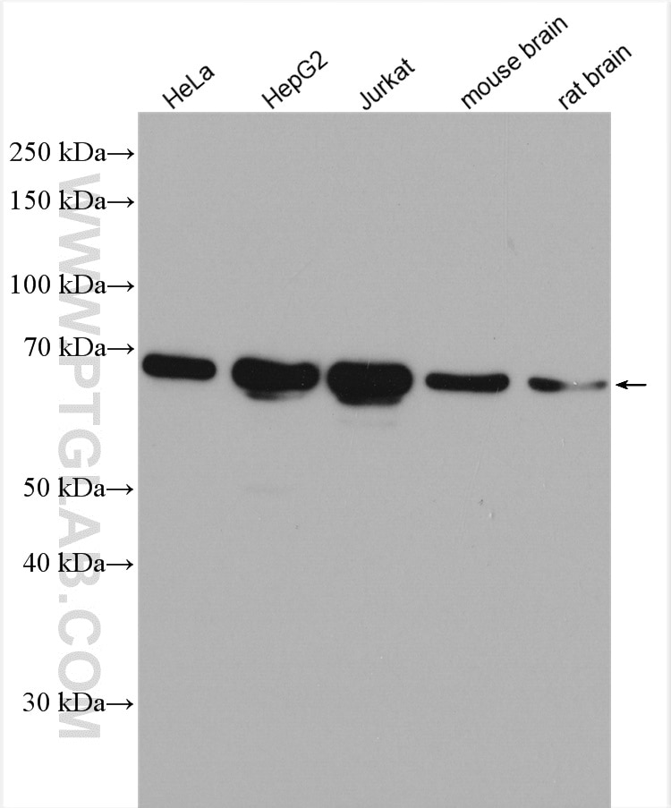 Western Blot (WB) analysis of various lysates using YTHDF1 Polyclonal antibody (17479-1-AP)