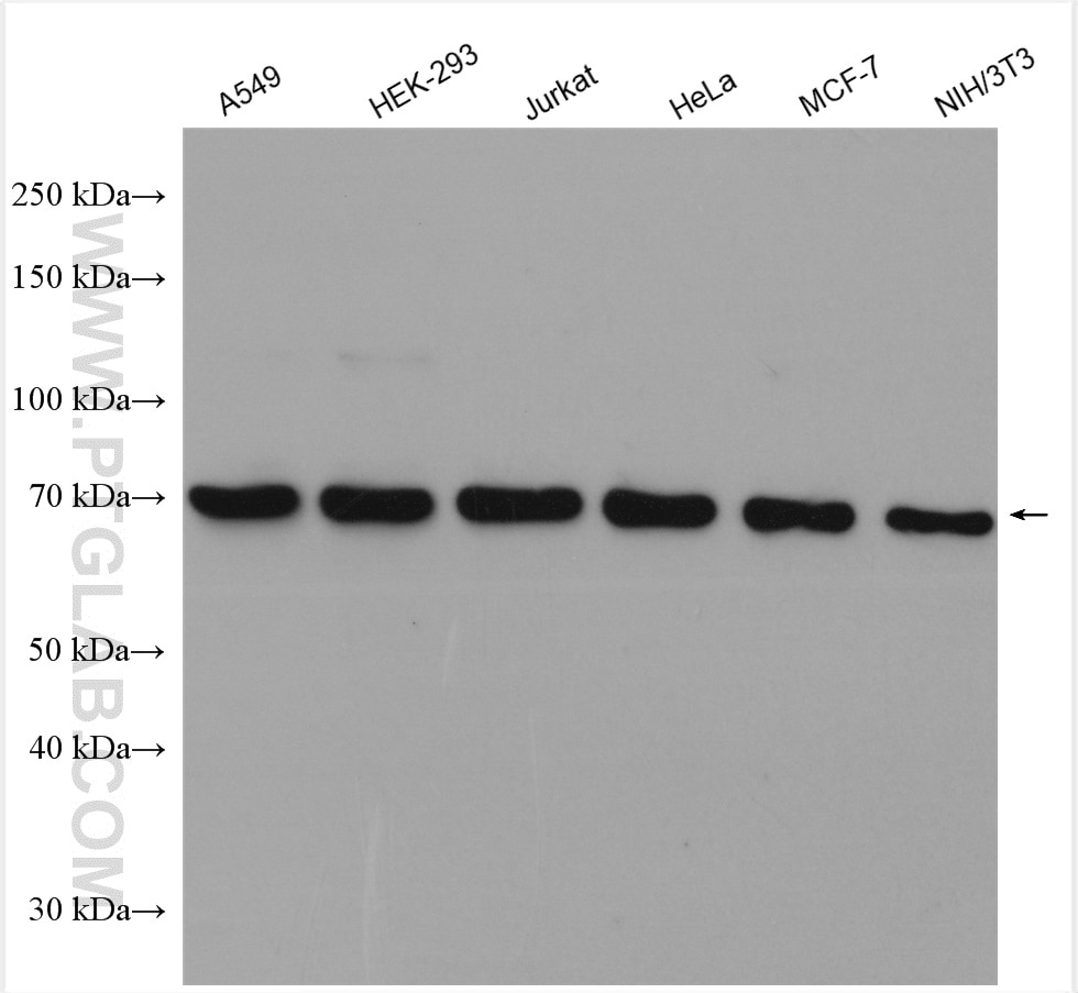 Western Blot (WB) analysis of various lysates using YTHDF1 Polyclonal antibody (17479-1-AP)