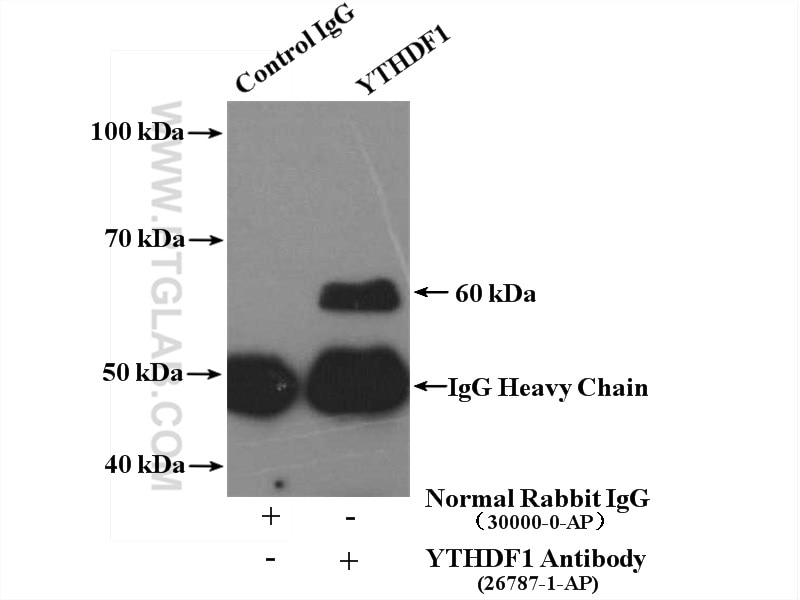 Immunoprecipitation (IP) experiment of HepG2 cells using YTHDF1 Polyclonal antibody (26787-1-AP)