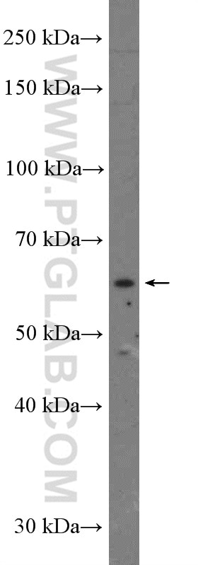 Western Blot (WB) analysis of HepG2 cells using YTHDF1 Polyclonal antibody (26787-1-AP)