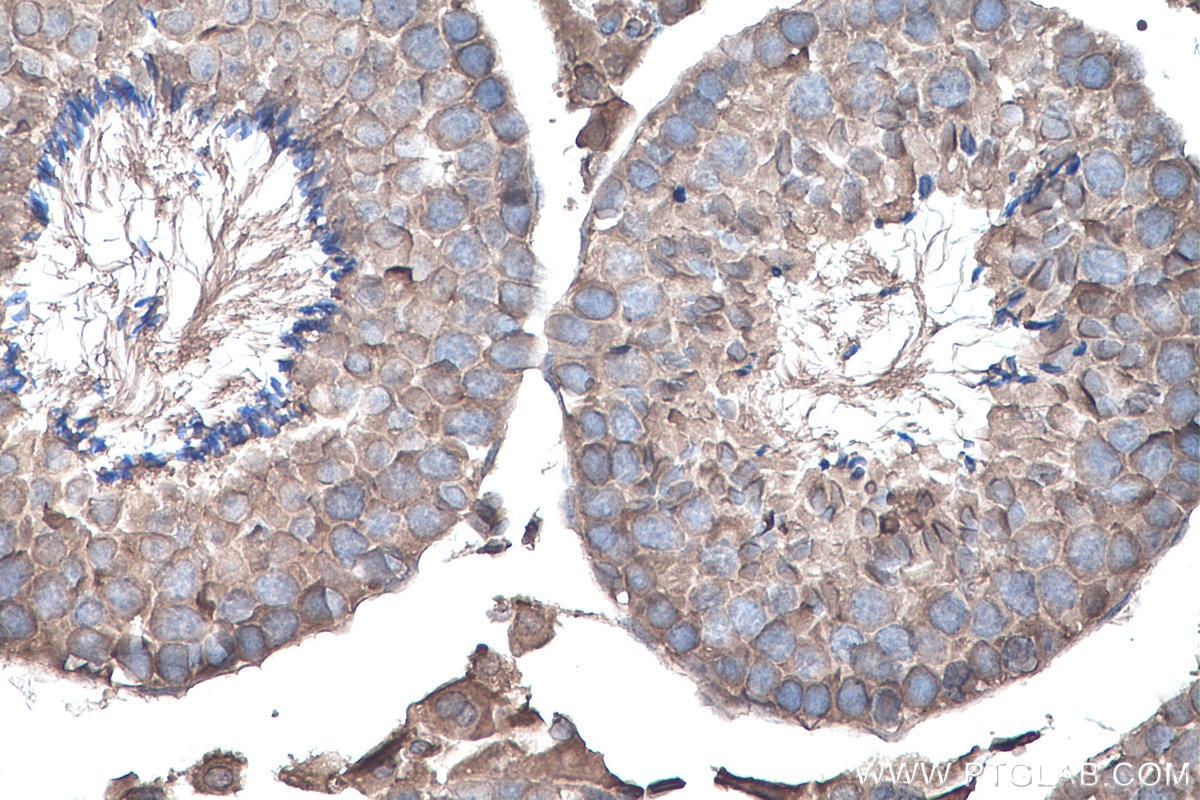 Immunohistochemistry (IHC) staining of mouse testis tissue using YTHDF1 Monoclonal antibody (66745-1-Ig)
