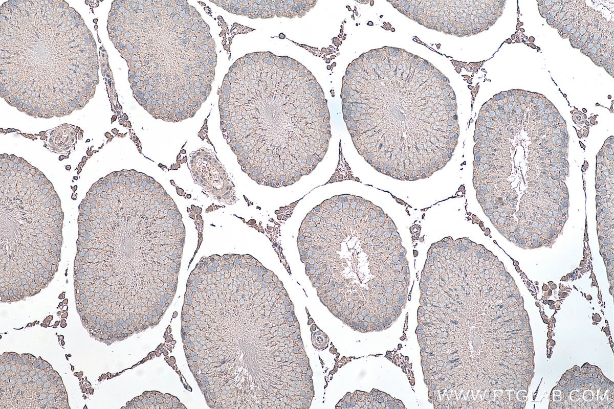 Immunohistochemistry (IHC) staining of rat testis tissue using YTHDF1 Monoclonal antibody (66745-1-Ig)
