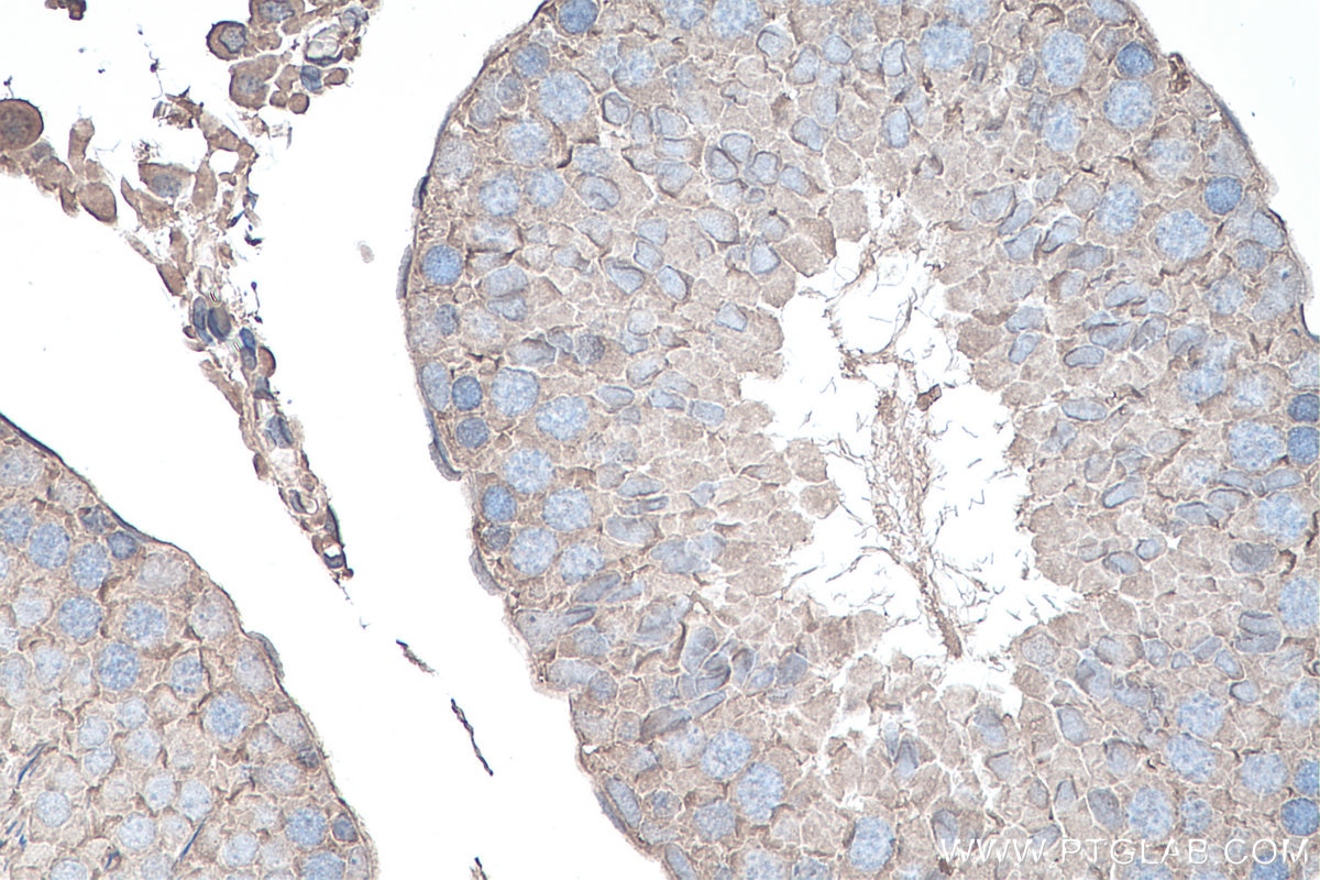 Immunohistochemistry (IHC) staining of rat testis tissue using YTHDF1 Monoclonal antibody (66745-1-Ig)