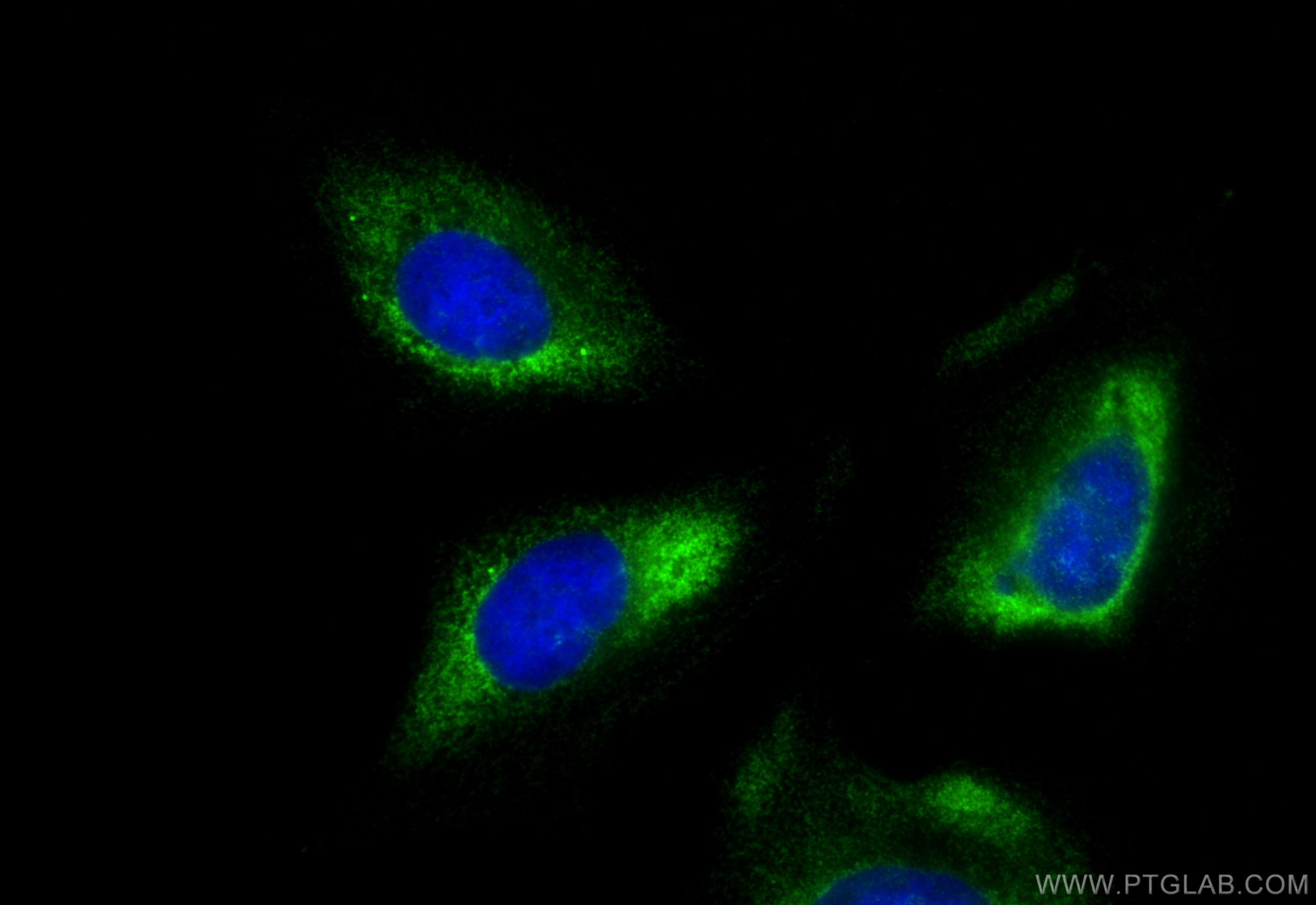 Immunofluorescence (IF) / fluorescent staining of U2OS cells using YTHDF1 Recombinant antibody (80876-2-RR)