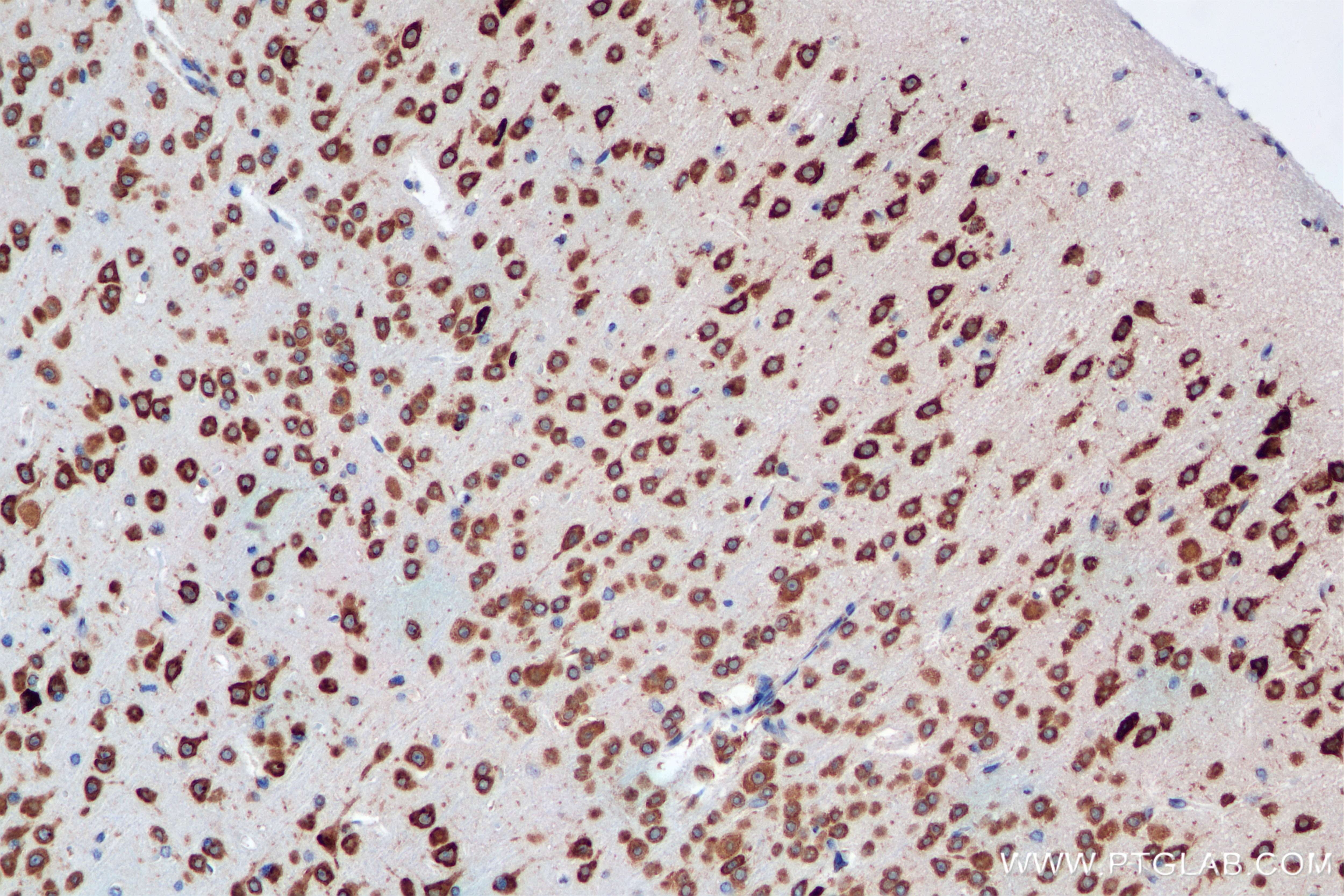 Immunohistochemistry (IHC) staining of mouse brain tissue using YTHDF1 Recombinant antibody (80876-2-RR)
