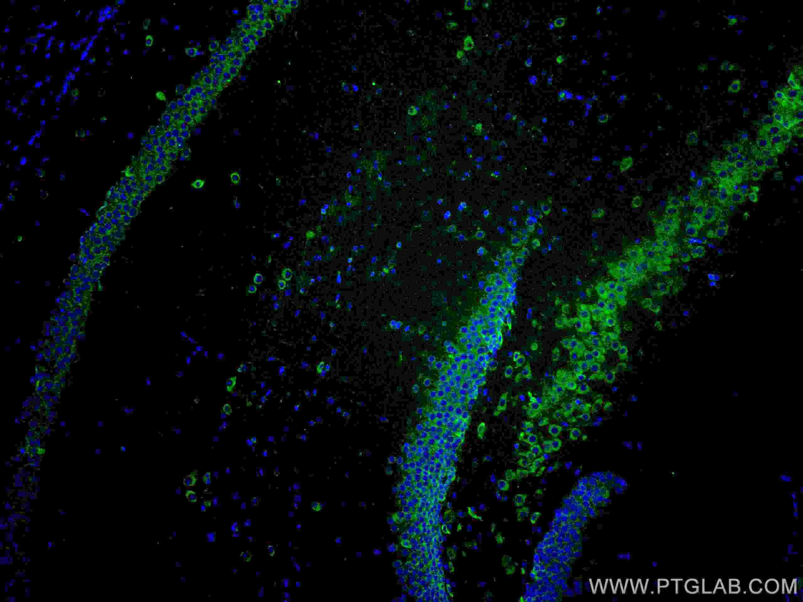 Immunofluorescence (IF) / fluorescent staining of mouse brain tissue using CoraLite® Plus 488-conjugated YTHDF1 Polyclonal an (CL488-17479)