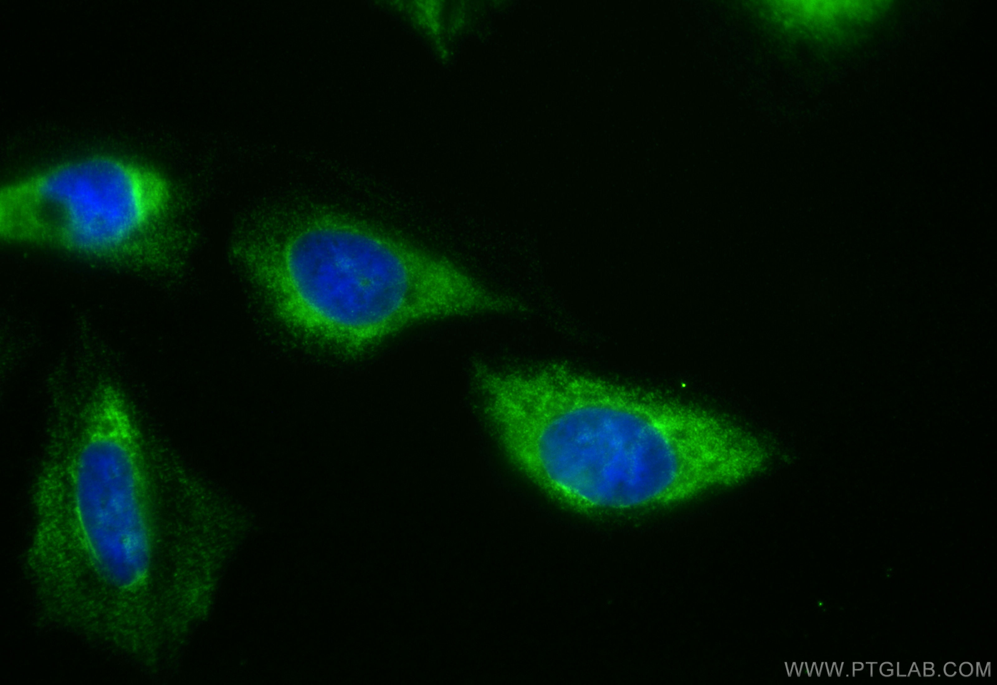 Immunofluorescence (IF) / fluorescent staining of U2OS cells using CoraLite® Plus 488-conjugated YTHDF1 Recombinant a (CL488-80876-2)