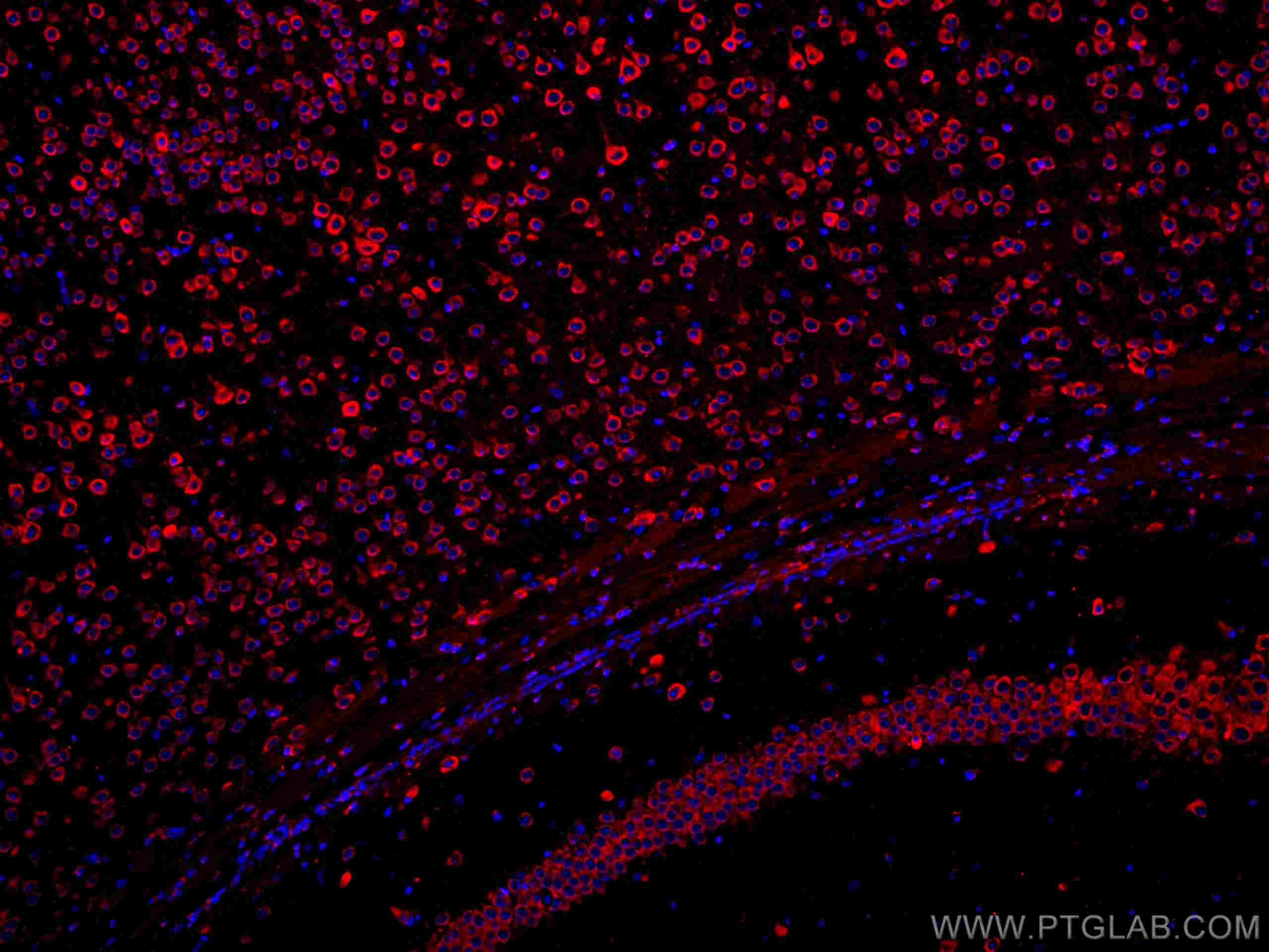 IF Staining of mouse brain using CL594-17479