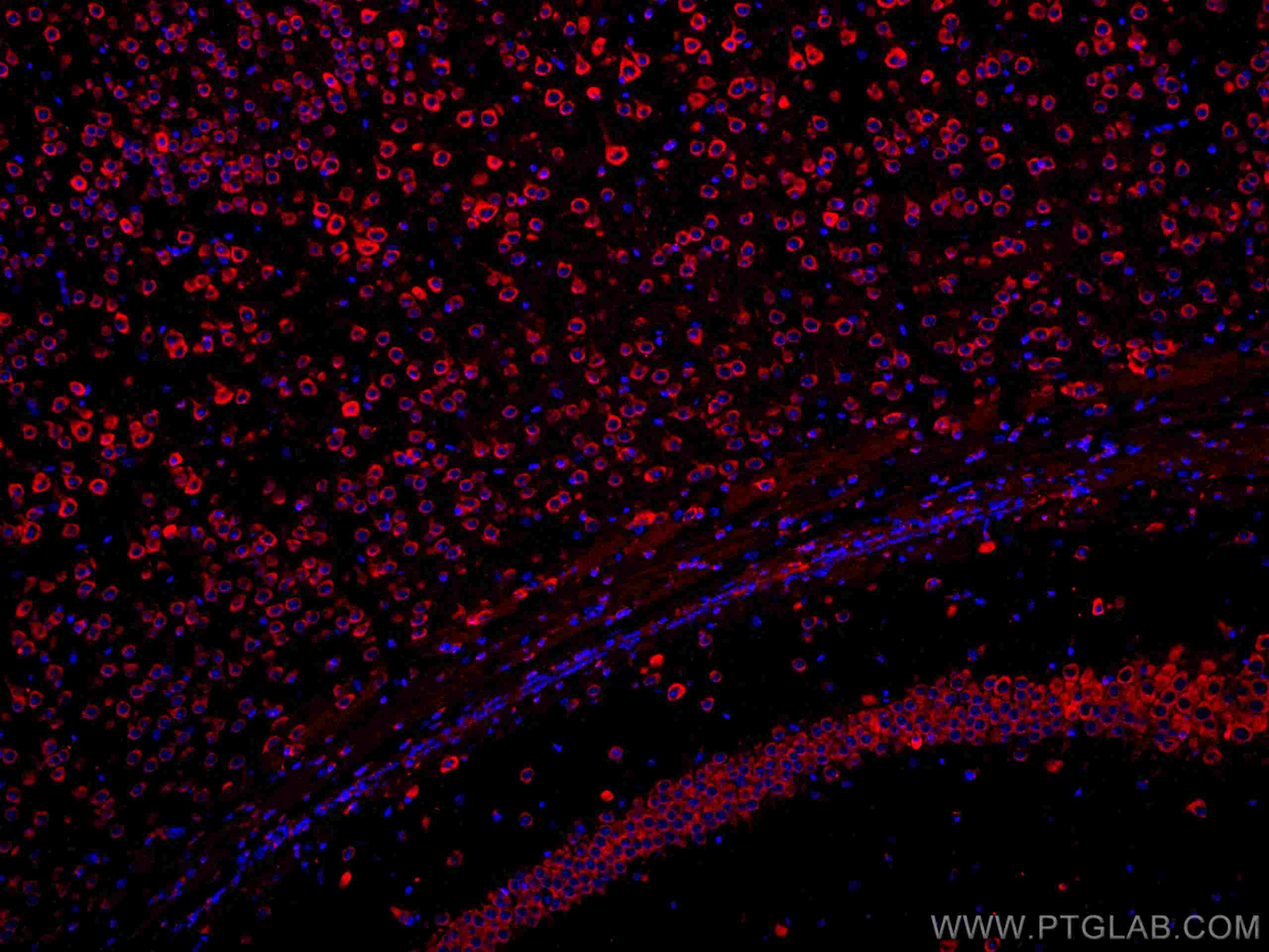 Immunofluorescence (IF) / fluorescent staining of mouse brain tissue using CoraLite®594-conjugated YTHDF1 Polyclonal antibody (CL594-17479)